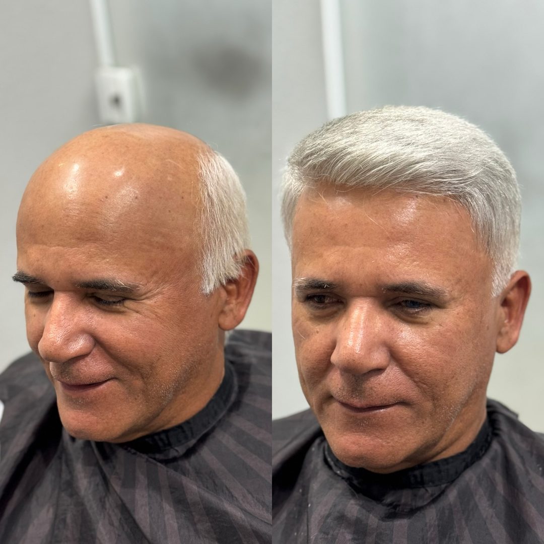 Antes e depois de prótese grisalha - homem de cabelos brancos