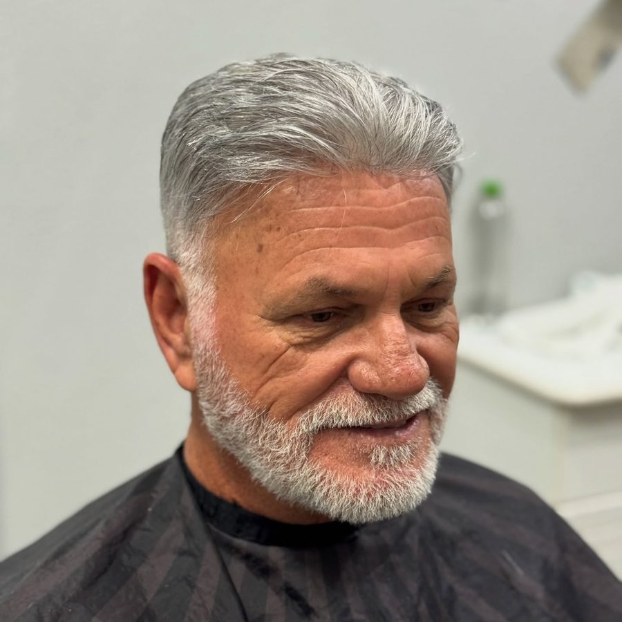 Resultado natural de prótese capilar sem necessidade de disfarce