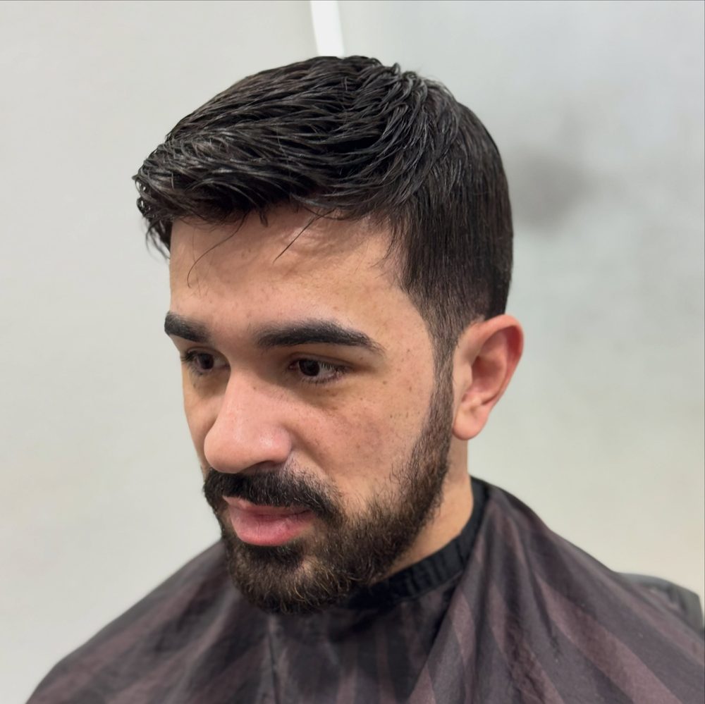 Resultado de prótese capilar masculina de micropele
